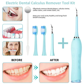 4 Intensity Modes IPX6 Waterproof Teeth Cleaner Kit Toothbrush Travel Strong Vibration Home For People Portable Multifunction
4 Intensity Modes IPX6 Waterproof Teeth Cleaner Kit Toothbrush Travel Strong Vibration Home For People Portable Multifunction