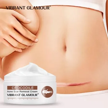 VIBRANT GLAMOUR Repair Scar Face Cream Anti-Aging Against Scalded Surgery Whitening Moisturizing Nourish Firming Skin Care
VIBRANT GLAMOUR Repair Scar Face Cream Anti-Aging Against Scalded Surgery Whitening Moisturizing Nourish Firming Skin Care