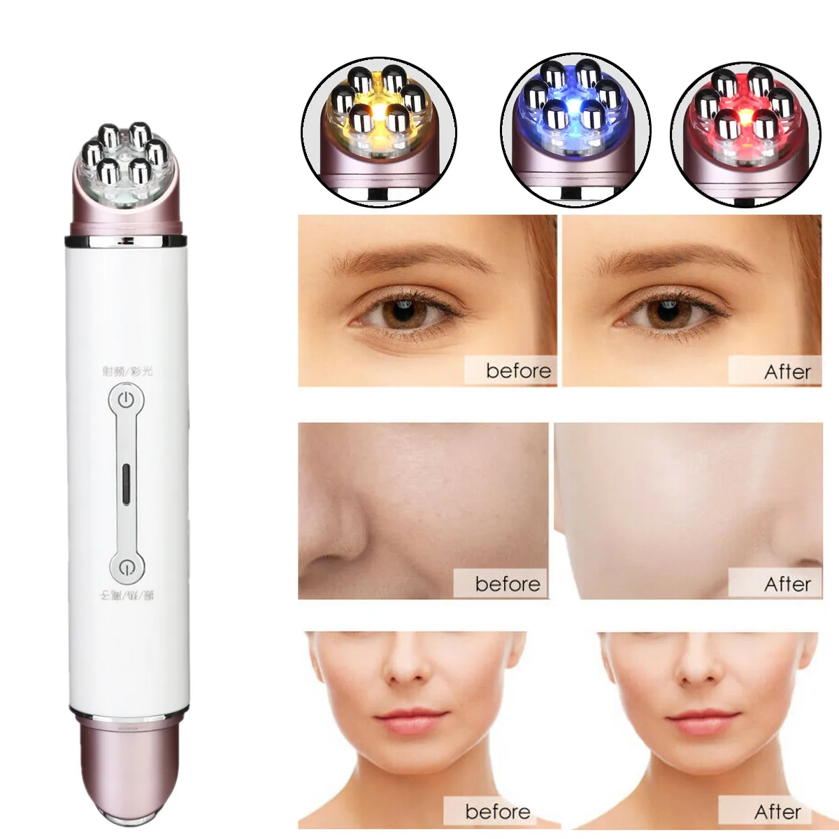 Double Head RF&EMS Radio Mesotherapy Electroporation Face Beauty Pen Frequency LED Photon Face Skin Rejuvenation Wrinkle Remover
Double Head RF&EMS Radio Mesotherapy Electroporation Face Beauty Pen Frequency LED Photon Face Skin Rejuvenation Wrinkle Remover
