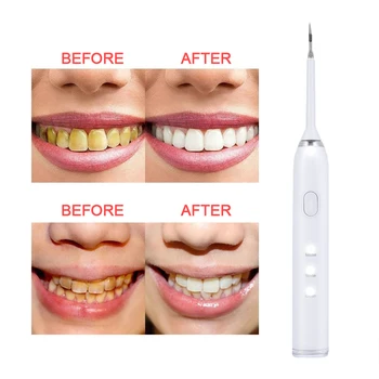 Effective Tooth Cleaner Travel Cleaning Toothbrush 3 Intensity Adjustment IPX6 Waterproof Grade High Frequency Vibration
Effective Tooth Cleaner Travel Cleaning Toothbrush 3 Intensity Adjustment IPX6 Waterproof Grade High Frequency Vibration