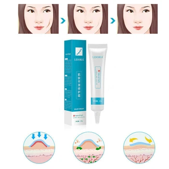 2019 Acne Scar Removal Cream Skin Repair Acne Spots Mark Blemish Treatment Face Cream 
2019 Acne Scar Removal Cream Skin Repair Acne Spots Mark Blemish Treatment Face Cream