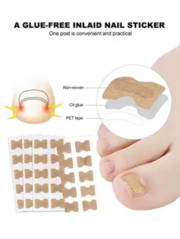 10/100Pc Nail Art Ingrown Correction Sticker Fixer Paronychia Recover Toenail Elastic Patch Corrector Foot Care Pedicure Tool
10/100Pc Nail Art Ingrown Correction Sticker Fixer Paronychia Recover Toenail Elastic Patch Corrector Foot Care Pedicure Tool
