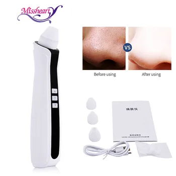 Blackhead Remover Pore Vacuum Cleaner Dark Spot Remover for Face with 1080P 500x Microscope Wifi Camera 3 Suction Heads
Blackhead Remover Pore Vacuum Cleaner Dark Spot Remover for Face with 1080P 500x Microscope Wifi Camera 3 Suction Heads
