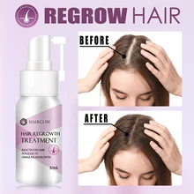 HAIRCUBE Hair Growth Essence Spray Hair Loss Treatment Stop Hair Loss Liquid Spray Hair Growth Essence Hair Care for Women 30ML 
HAIRCUBE Hair Growth Essence Spray Hair Loss Treatment Stop Hair Loss Liquid Spray Hair Growth Essence Hair Care for Women 30ML