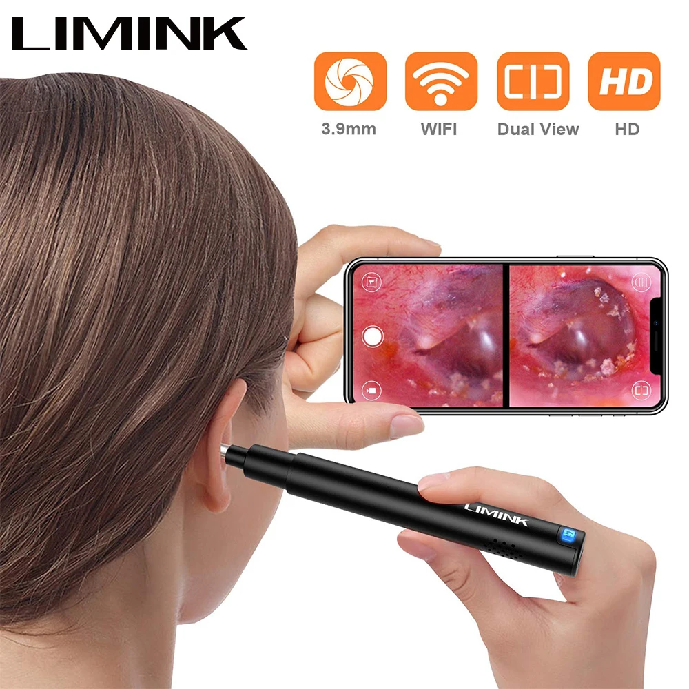 LIMINK 3.9mm Wireless Otoscope with Dual View HD Ear Camera WiFi Ear Scope with LED Lights Ear Endoscope for Kids and Adults
LIMINK 3.9mm Wireless Otoscope with Dual View HD Ear Camera WiFi Ear Scope with LED Lights Ear Endoscope for Kids and Adults