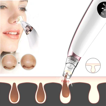 Electric Acne Remover Point Noir Blackhead Vacuum Extractor Tool Black Spots Pore Cleaner Skin Care Facial Pore Cleaner Tools
Electric Acne Remover Point Noir Blackhead Vacuum Extractor Tool Black Spots Pore Cleaner Skin Care Facial Pore Cleaner Tools