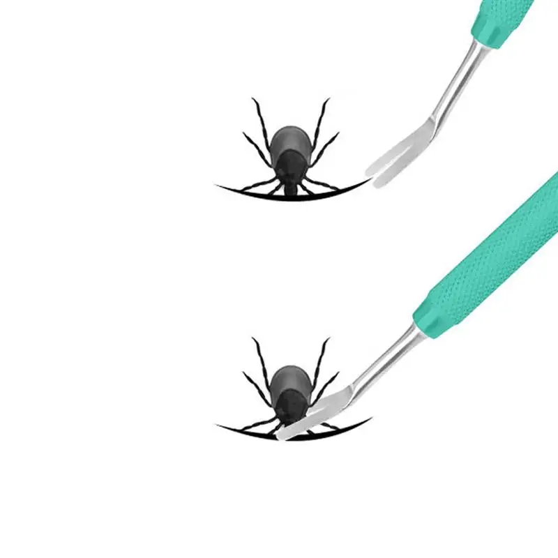 2pcs Useful Pet Dogs Flea Cleaning Tool Practical Dog Cat Cleaning Hair Tool Flea Ovum Remover For Puppy Pet Cat Dogs
2pcs Useful Pet Dogs Flea Cleaning Tool Practical Dog Cat Cleaning Hair Tool Flea Ovum Remover For Puppy Pet Cat Dogs