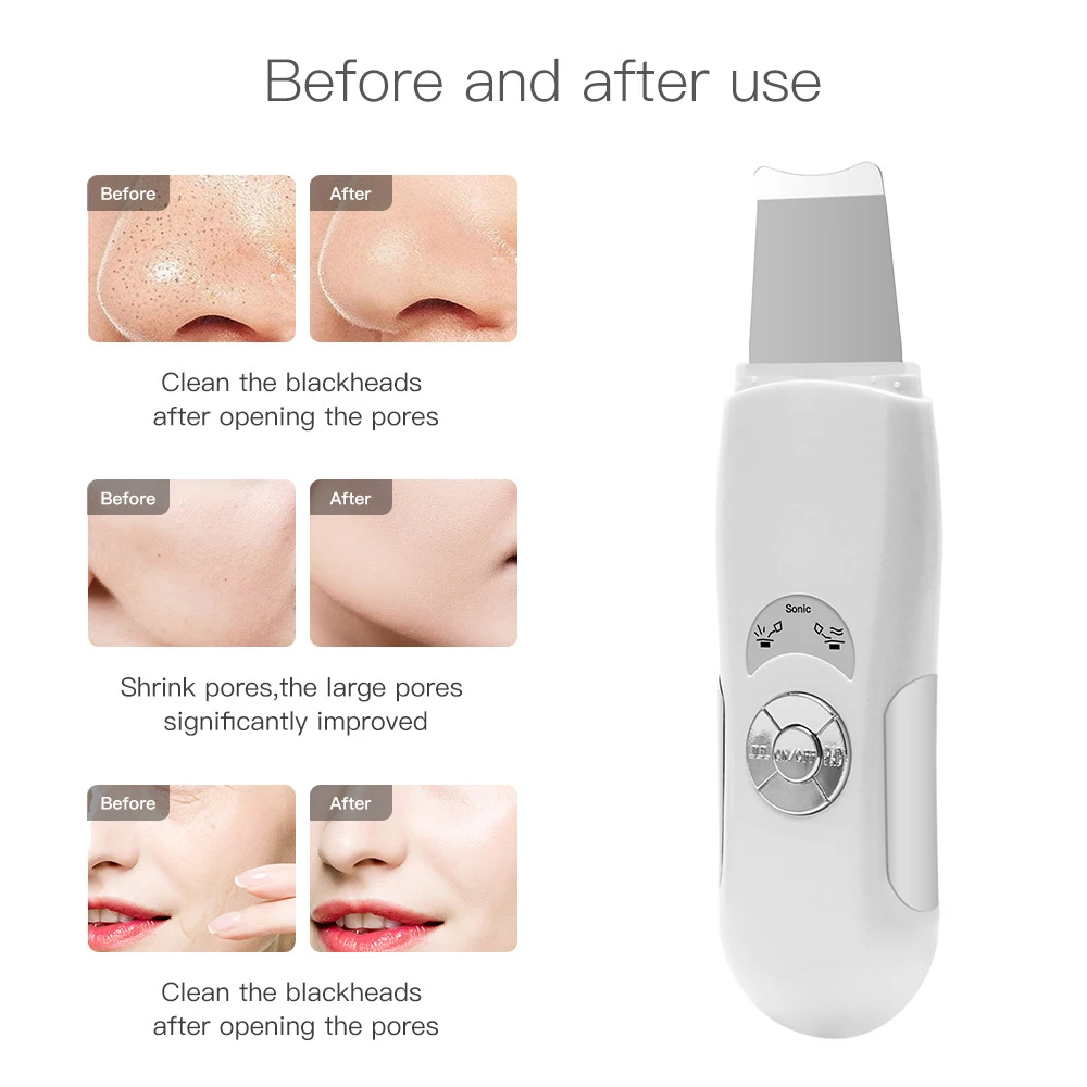 Professional Ultrasonic Facial Skin Scrubber Ion Deep Face Cleaning Peeling Rechargeable Skin Care Device Beauty Instrument VIP 
Professional Ultrasonic Facial Skin Scrubber Ion Deep Face Cleaning Peeling Rechargeable Skin Care Device Beauty Instrument VIP
