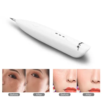 Ckeyin Professional Blackhead Acne Removal Machine Face Care Skin Mole Remover For Women Men Face Deep Cleaning Beauty Tool
Ckeyin Professional Blackhead Acne Removal Machine Face Care Skin Mole Remover For Women Men Face Deep Cleaning Beauty Tool