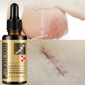 Lavender Oil Stretch Marks Remover Cream Serum,Maternity Skin Repair Oil Repair Surgical Scar Burn Marks Acne Essence Care 30ML
Lavender Oil Stretch Marks Remover Cream Serum,Maternity Skin Repair Oil Repair Surgical Scar Burn Marks Acne Essence Care 30ML