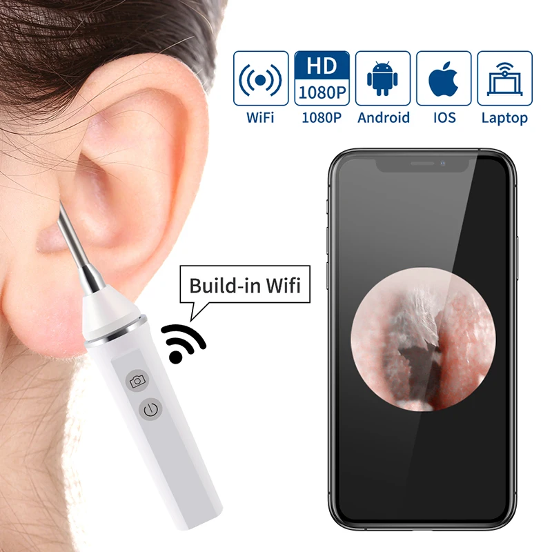 2019 New 3.9MM 5.0MP WiFi Ear Endoscope Earwax Cleaning Tool Ear Spoonwith 6 Led Lights Borescope for Android, iOS, Smartphone
2019 New 3.9MM 5.0MP WiFi Ear Endoscope Earwax Cleaning Tool Ear Spoonwith 6 Led Lights Borescope for Android, iOS, Smartphone