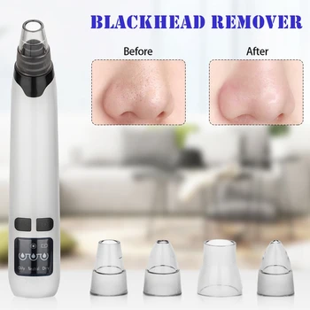 Blackhead Remover Electric Remove Pimple Acne Black Spot Machine Facial Skin Care Cleanser Oil Control Anti Aging Beauty Care
Blackhead Remover Electric Remove Pimple Acne Black Spot Machine Facial Skin Care Cleanser Oil Control Anti Aging Beauty Care