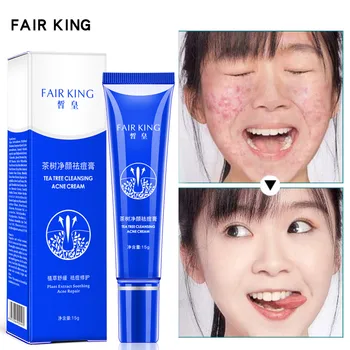 Effective Acne Cream/Whitening Freckle Cream 20g Moisturizing Remove Melasma Acne Spots Treatment Pigment Melanin Whitening
Effective Acne Cream/Whitening Freckle Cream 20g Moisturizing Remove Melasma Acne Spots Treatment Pigment Melanin Whitening
