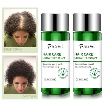 2Types Hair Growth Essence Natural Ginger Hair Serum Anti Hair Loss Products Fast Growth Dense Hairs Serum Anti Loss Treatments 
2Types Hair Growth Essence Natural Ginger Hair Serum Anti Hair Loss Products Fast Growth Dense Hairs Serum Anti Loss Treatments