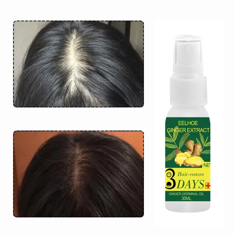 30 мл Pro роста волос имбиря зародышевый Сыворотки масло выпадения лечения Для