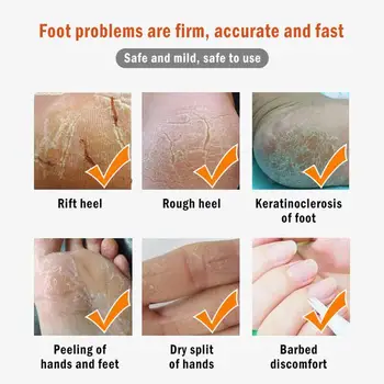 50ml Anti-Drying Crack Foot Cream Heel Cracked Repair Hand Removal Cream Feet Cream Skin Moisturizing Dead Foot Care X8O7
50ml Anti-Drying Crack Foot Cream Heel Cracked Repair Hand Removal Cream Feet Cream Skin Moisturizing Dead Foot Care X8O7