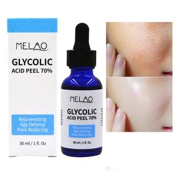 Glycolic Acid Peel 70% Shrink Pores Brighten Skin Color Balance Water And Oil Improve Acne Skin Nourishing W2
Glycolic Acid Peel 70% Shrink Pores Brighten Skin Color Balance Water And Oil Improve Acne Skin Nourishing W2