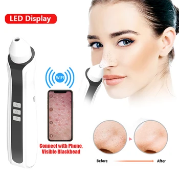 Review Blackhead Remover Vacuum with Built-in HD Camera Review Acne Pore Cleaner WiFi Visual Facial Blackhead Extractor Tool
Review Blackhead Remover Vacuum with Built-in HD Camera Review Acne Pore Cleaner WiFi Visual Facial Blackhead Extractor Tool