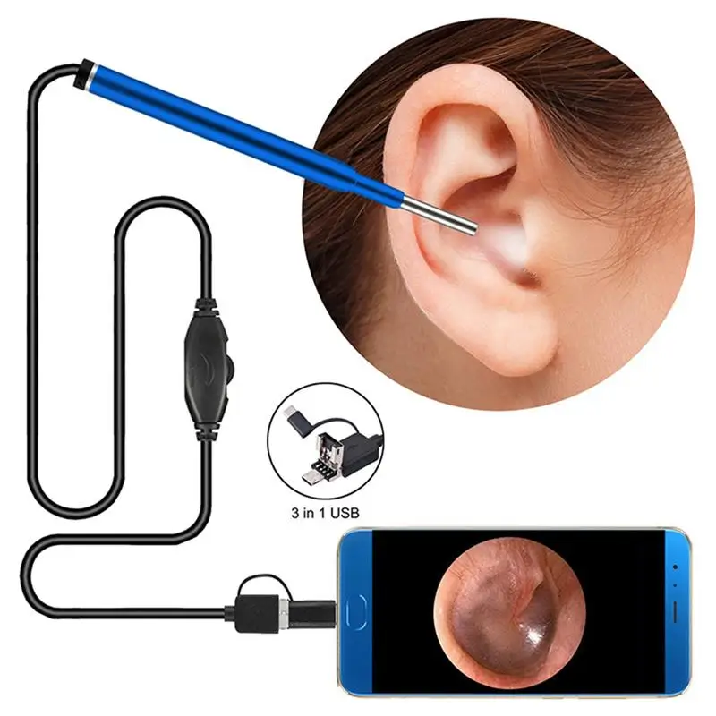 3 In 1 Ear Scoop Camera Ear Inspection Borescope Ear Cleaner Ear Nursing Suplies for Women Men (Blue)
3 In 1 Ear Scoop Camera Ear Inspection Borescope Ear Cleaner Ear Nursing Suplies for Women Men (Blue)