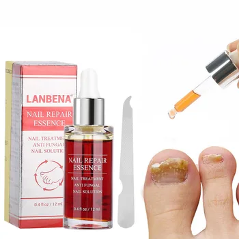 12 ML Nail Care Solution Natural Powerful Nail Repair Essence Anti-Fungus Nail Treatment Effective Repair Solutions Nail File
12 ML Nail Care Solution Natural Powerful Nail Repair Essence Anti-Fungus Nail Treatment Effective Repair Solutions Nail File