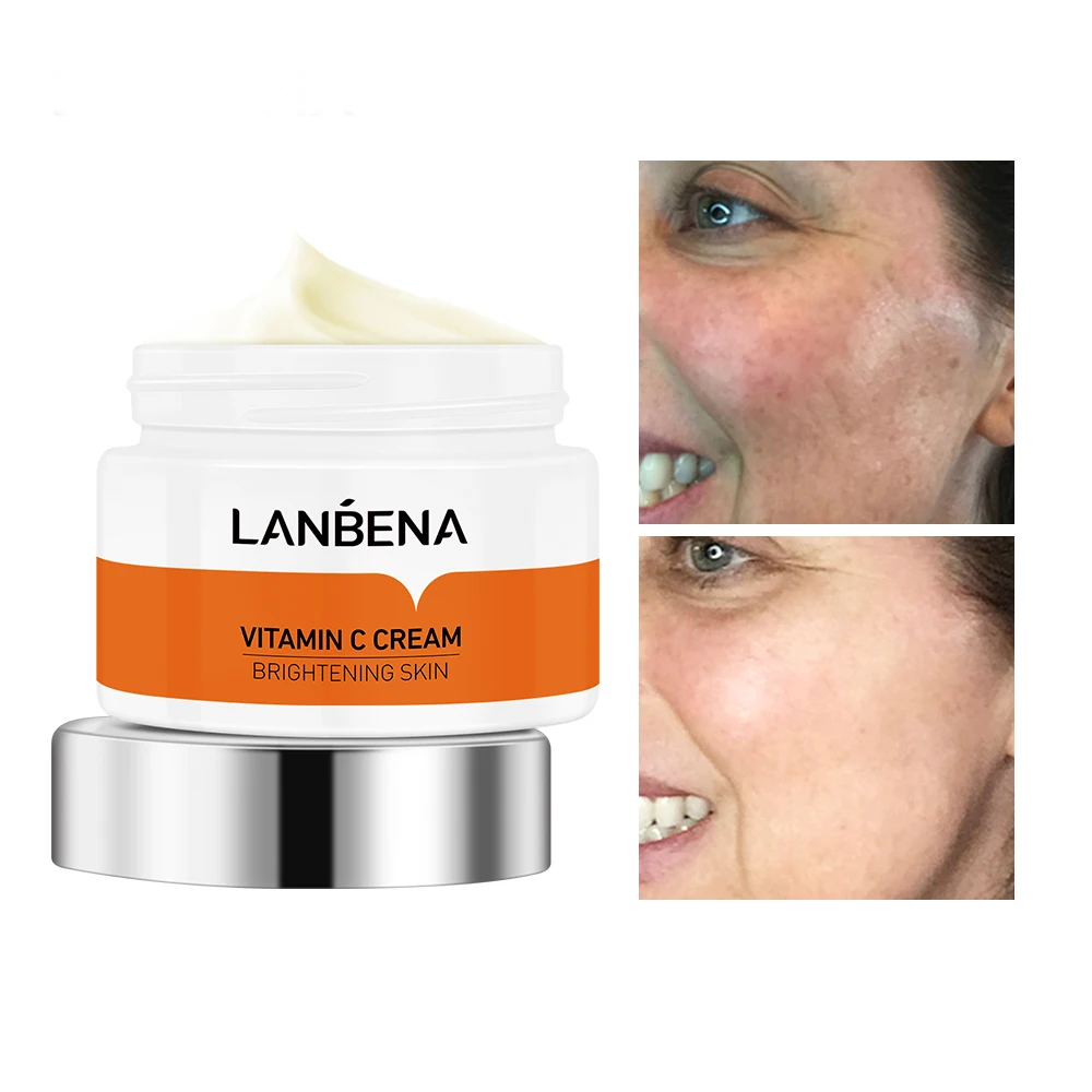 Vitamin C Face Cream Whitening Nourish Brighten Remove Freckle Improving Dull Skin Anti Aging Refreshing Not Greasy 50g
Vitamin C Face Cream Whitening Nourish Brighten Remove Freckle Improving Dull Skin Anti Aging Refreshing Not Greasy 50g
