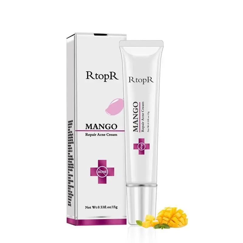 different acne cream