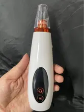 Removedor profundo espinilla profesional, limpieza de poros, vacío, belleza Facial, cuidado de la piel, herramientas