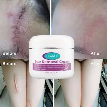 New Remove Pregnancy Scars Cream Maternity Pigment Correction Repair Body Gel Firming Lifting Brighten Stretch Marks 50ml
New Remove Pregnancy Scars Cream Maternity Pigment Correction Repair Body Gel Firming Lifting Brighten Stretch Marks 50ml