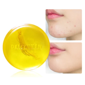 face Handmade Soap Cleaner Removal Pimple Pores Acne Treatment Whitening Moisturizing Face Care Wash Basis Soap Face Care TSLM2
face Handmade Soap Cleaner Removal Pimple Pores Acne Treatment Whitening Moisturizing Face Care Wash Basis Soap Face Care TSLM2