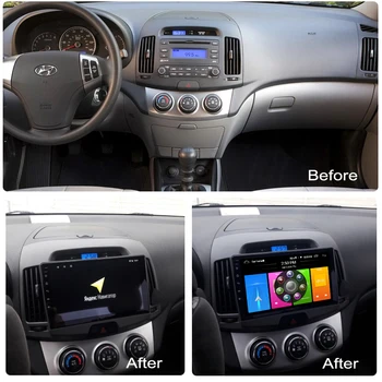 Car Radio Android 10.0 GPS Navigation For HYUNDAI Elantra 2011 Head Unit Usb Multimedia Cassette Recorder Player Full Touch 
Car Radio Android 10.0 GPS Navigation For HYUNDAI Elantra 2011 Head Unit Usb Multimedia Cassette Recorder Player Full Touch