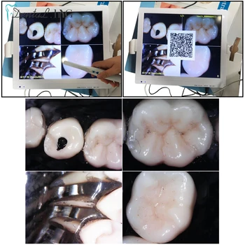 New Arrival 17 Inch Wifi Intraoral Camera Endoscope 1/4 CMOS All in One LCD Monitor 6 LED USB Dental Equipment Oral Camera
New Arrival 17 Inch Wifi Intraoral Camera Endoscope 1/4 CMOS All in One LCD Monitor 6 LED USB Dental Equipment Oral Camera
