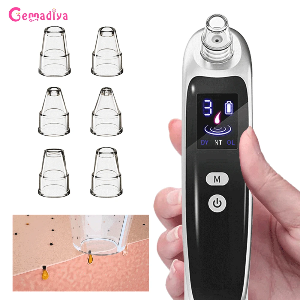 Blackhead Remover Pore Vacuum Cleaner Pimples Acne Removers Electric Nose Black Dots Remover Face Cleansing Blackhead Instrument
Blackhead Remover Pore Vacuum Cleaner Pimples Acne Removers Electric Nose Black Dots Remover Face Cleansing Blackhead Instrument