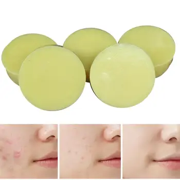 Antibacterial Disinfection Sulfur Soap Whitening Oil Control Acne Treatment Blackhead Mite Remover Soap Body Soap Skin Care
Antibacterial Disinfection Sulfur Soap Whitening Oil Control Acne Treatment Blackhead Mite Remover Soap Body Soap Skin Care