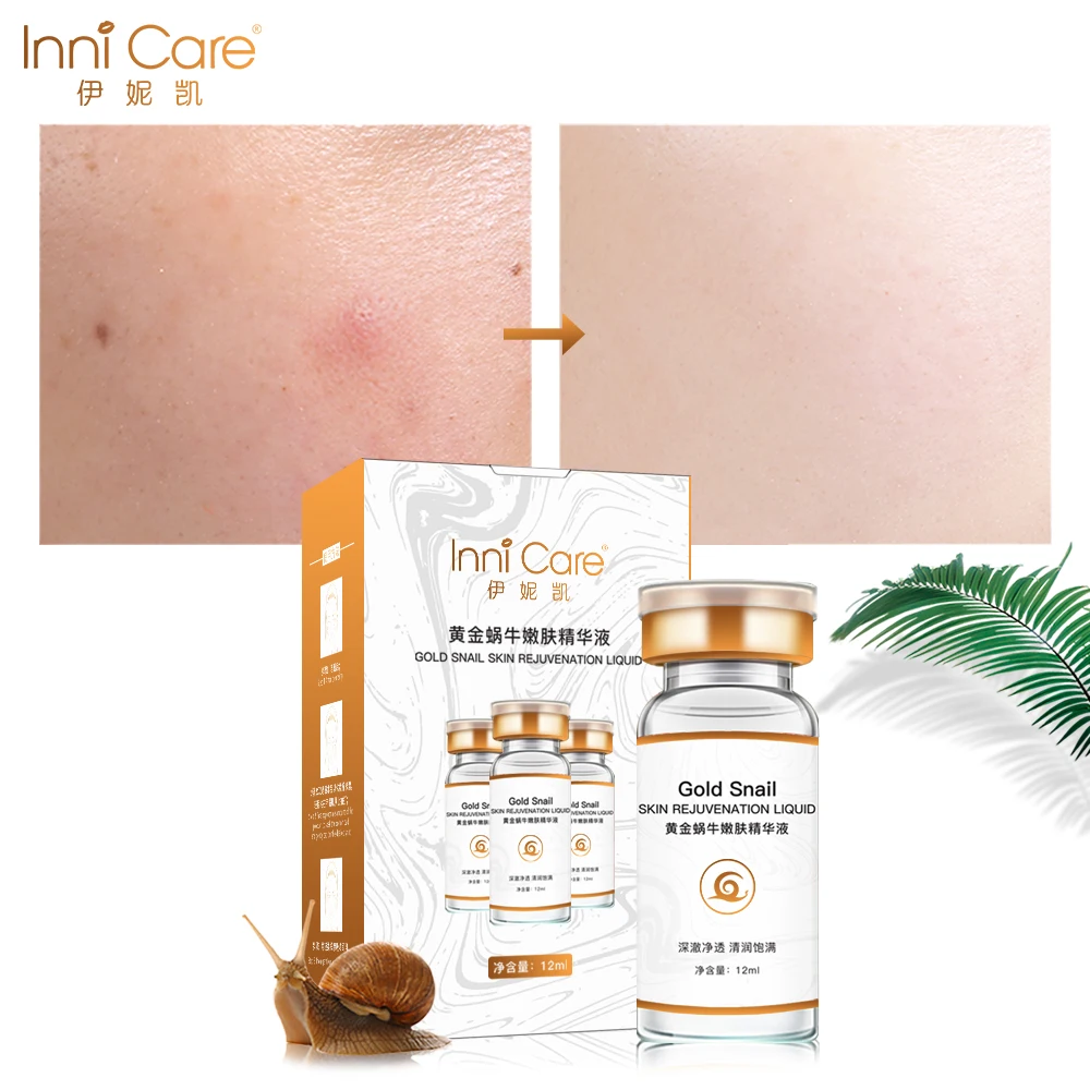 AFY Snail Cream Face Skin Care Treatment Reduce Scars Acne Pimples Moisturizing Whitening Anti Winkles Aging Cream
AFY Snail Cream Face Skin Care Treatment Reduce Scars Acne Pimples Moisturizing Whitening Anti Winkles Aging Cream