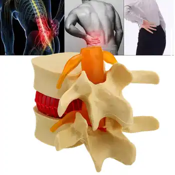 Human Lumbar Vertebrae Model High Quality Anatomical Medical Props Anatomical Spine Lumbar Disc Herniation Teaching Tool
Human Lumbar Vertebrae Model High Quality Anatomical Medical Props Anatomical Spine Lumbar Disc Herniation Teaching Tool