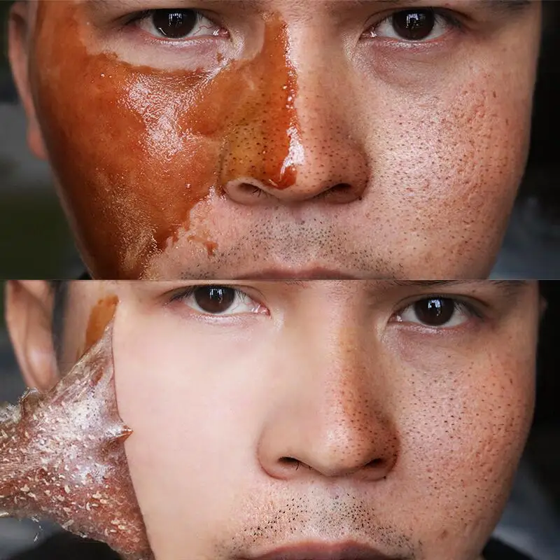 Honey Exfoliating Mask Oil Control In addition to Blackheads Acne Removal Dead Skin Cleansing Pore Reduction Face Skin Care Mask
Honey Exfoliating Mask Oil Control In addition to Blackheads Acne Removal Dead Skin Cleansing Pore Reduction Face Skin Care Mask