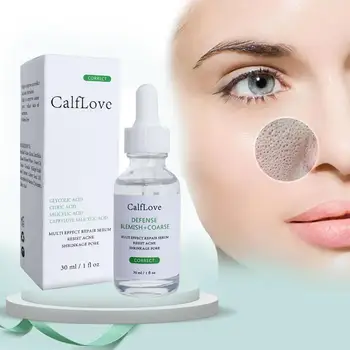 30ml Salicylic Acid Shrink Pores Essence Face Skin Care Anti-blackhead Essence 
30ml Salicylic Acid Shrink Pores Essence Face Skin Care Anti-blackhead Essence