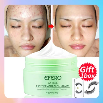Tea Tree Acne Cream Whitening Face Cream Moisturizing Oil-control Pimple Scar Blackhead Remove Skin Care Acne Treatment
Tea Tree Acne Cream Whitening Face Cream Moisturizing Oil-control Pimple Scar Blackhead Remove Skin Care Acne Treatment