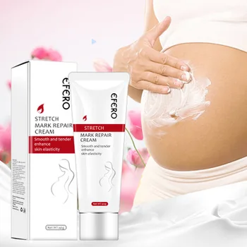 EFERO 40g Stretch Mark repair cream Smooth tender enchance skin care 
EFERO 40g Stretch Mark repair cream Smooth tender enchance skin care