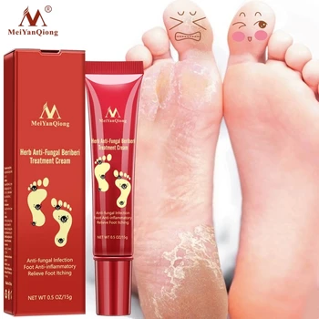 Meiyanqiong Foot Care Cream Foot spa Pedicure Herbal Detox Anti Fungal Infection Onychomycosis Fungus Treatment For legs 15g
Meiyanqiong Foot Care Cream Foot spa Pedicure Herbal Detox Anti Fungal Infection Onychomycosis Fungus Treatment For legs 15g