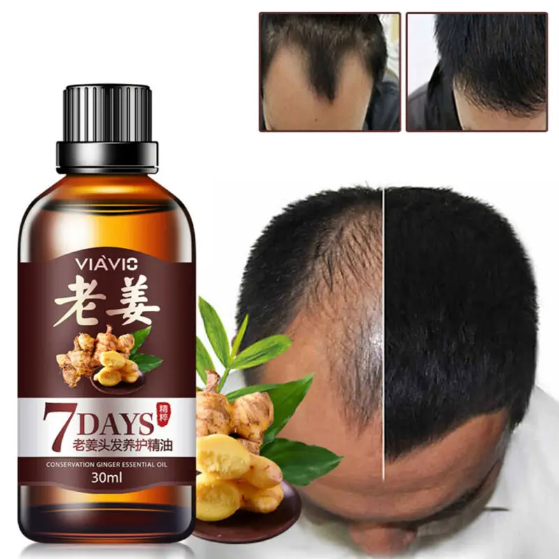 Rapid hair growth intensive regenerating ginger serum oil anti-off treatment essence
Rapid hair growth intensive regenerating ginger serum oil anti-off treatment essence