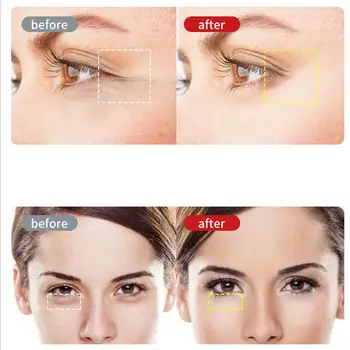Electric Anti Wrinkle Eye Massager rf Ultrasonic Multifunction Anti Eye Eye Massage Pen Aging Beauty Care Tools Massage Dev E4T4
Electric Anti Wrinkle Eye Massager rf Ultrasonic Multifunction Anti Eye Eye Massage Pen Aging Beauty Care Tools Massage Dev E4T4