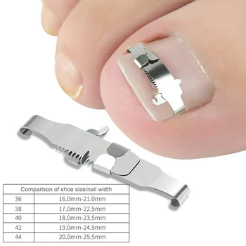 Nail Pedicure Ingrown Toenail Correction Tool Set Patch Stickers Straightening Clip Brace Inset Buckle Foot Care Accessories
Nail Pedicure Ingrown Toenail Correction Tool Set Patch Stickers Straightening Clip Brace Inset Buckle Foot Care Accessories