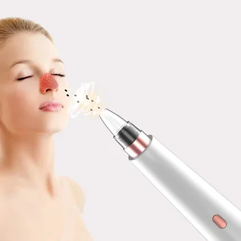 Vacuum Suction Blackhead Remover Acne Pimple Face Deep Cleansing Pore Cleaner Facial Machine Skin Care
Vacuum Suction Blackhead Remover Acne Pimple Face Deep Cleansing Pore Cleaner Facial Machine Skin Care