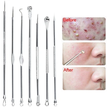 7pcs Stainless Steel Blackhead Remover Tool Set Pimple Spot Comedone Acne Blemish Extractor Beauty Tool Kits
7pcs Stainless Steel Blackhead Remover Tool Set Pimple Spot Comedone Acne Blemish Extractor Beauty Tool Kits