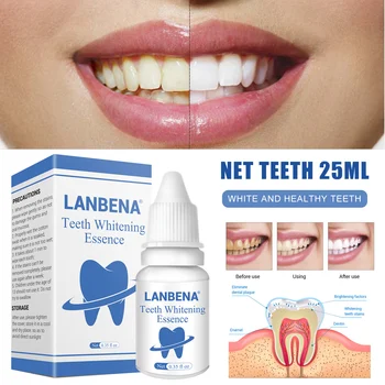 Mint Teeth Whitening Essence Remove Coffee Wine Tobacco Stains and Freshen Breath No Damage to Enamel SSwell
Mint Teeth Whitening Essence Remove Coffee Wine Tobacco Stains and Freshen Breath No Damage to Enamel SSwell