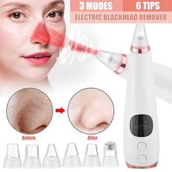 Blackhead Remover Face Cleaner Deep Pore Acne Pimple Removal Vacuum Suction Diamond Beauty Tool Facial Household SPA Skin Care
Blackhead Remover Face Cleaner Deep Pore Acne Pimple Removal Vacuum Suction Diamond Beauty Tool Facial Household SPA Skin Care