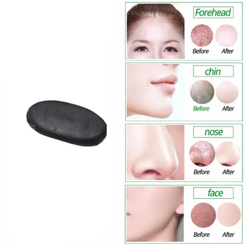 Active bamboo charcoal soap for eliminating acne thinning body and reducing face whitening soap for men and women Removal acne
Active bamboo charcoal soap for eliminating acne thinning body and reducing face whitening soap for men and women Removal acne