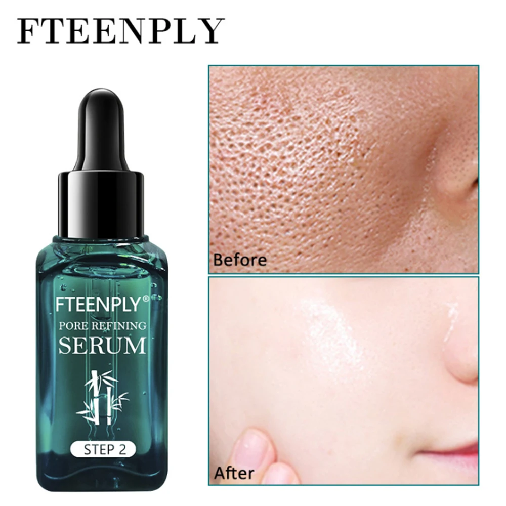 FTEENPLY Pore Refining Face Serum Shrinking Pore Deep Hydrating Moisturizer Oil Control Acne Treatment Reparing Facial Skin Care
FTEENPLY Pore Refining Face Serum Shrinking Pore Deep Hydrating Moisturizer Oil Control Acne Treatment Reparing Facial Skin Care