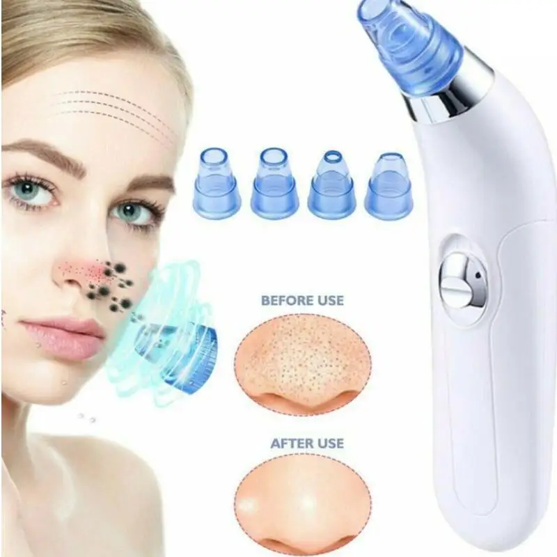 Blackhead Remover Face Deep Nose Cleaner T Zone Pore Acne Pimple Removal Vacuum Suction Facial Diamond Beauty Clean Skin Tool
Blackhead Remover Face Deep Nose Cleaner T Zone Pore Acne Pimple Removal Vacuum Suction Facial Diamond Beauty Clean Skin Tool